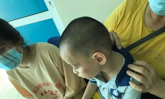 Trong số nhiều người bị chó cắn, có cả em bé bị tấn công vào má, tay rất nguy hiểm. - Ảnh: TL