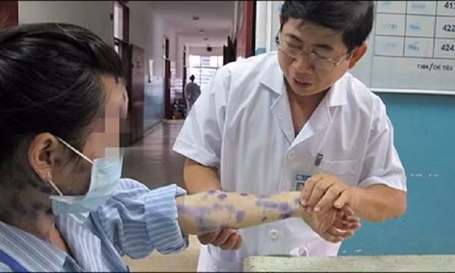 Cách phòng tránh những mối nguy hại từ thời tiết nồm ẩm