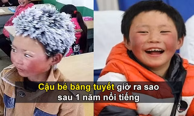 Cậu bé băng tuyết giờ ra sao sau 1 năm nổi tiếng