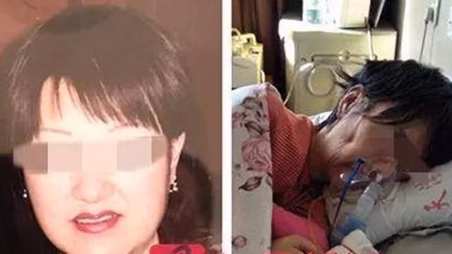 “Hot“: Nữ doanh nhân hút mỡ thất bại trở thành người thực vật, mất sau 10 năm liệt giường