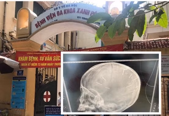 Gia đình người tình của mẹ bé gái bị ghim 9 chiếc đinh trong đầu nói gì?