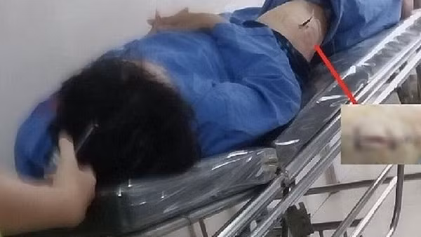 Đối tượng đâm cán bộ Cục thuế Ninh Bình khai gì tại cơ quan Công an?