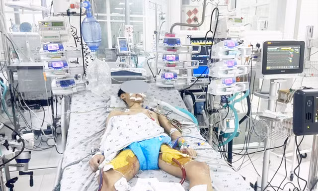 Nguy cơ trẻ bị viêm cơ tim 