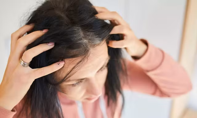 Tại sao chỉ sau một đêm có người bạc trắng đầu?
