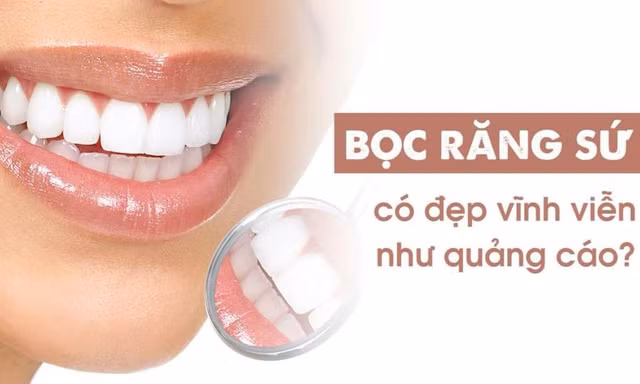 Bọc răng sứ có đẹp vĩnh viễn như quảng cáo?
