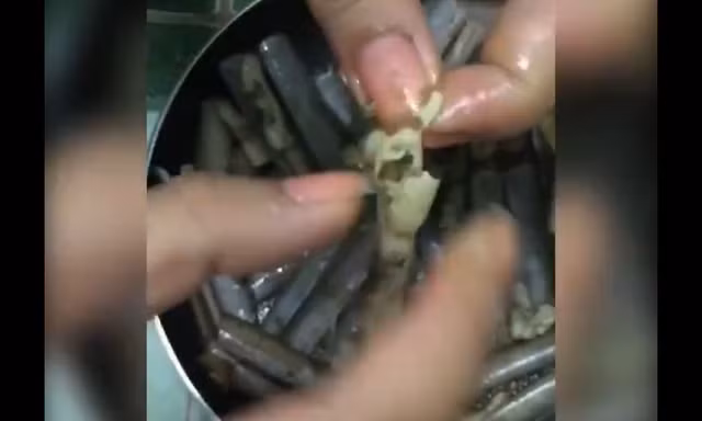 Kinh hoàng giòi nằm trong ruột ốc móng tay