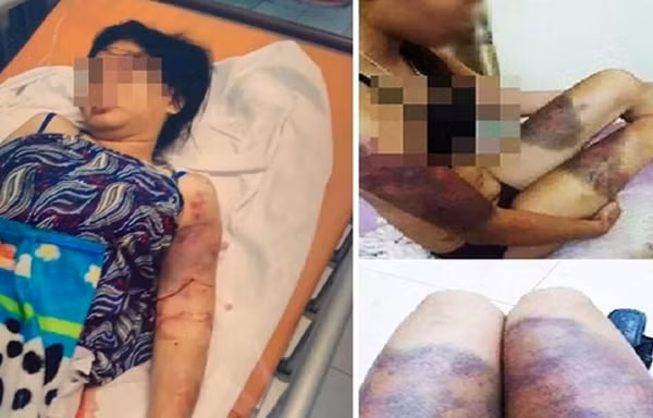 Bố cô gái bị giam giữ, tra tấn suốt 21 ngày: 'Tôi đau như chết đi sống lại'