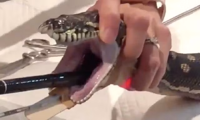 Các bác sĩ chuẩn bị kéo chiếc khăn tắm khỏi bụng trăn