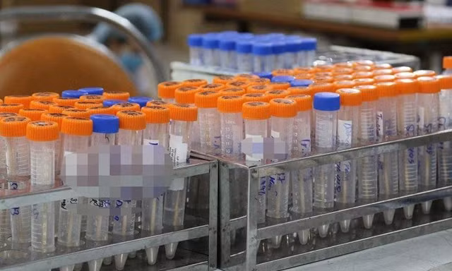 Thiết bị y tế, sinh phẩm xét nghiệm là mặt hàng phải kê khai giá