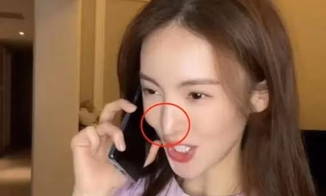 Nữ diễn viên Kim Thần bị biến dạng gương mặt