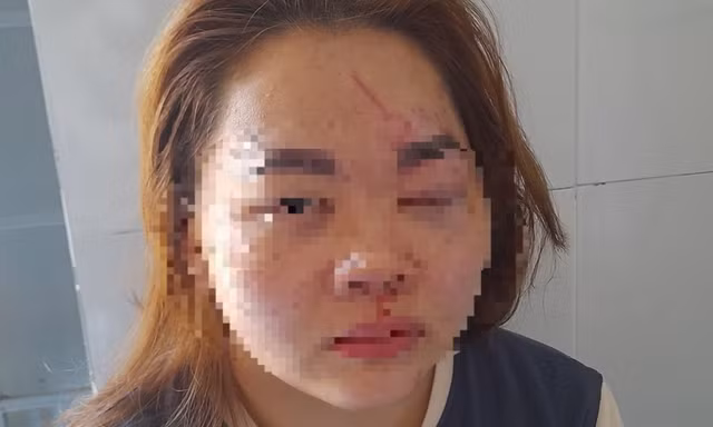 Thầy giáo nhận lỗi sau khi đánh vợ phải nhập viện cấp cứu
