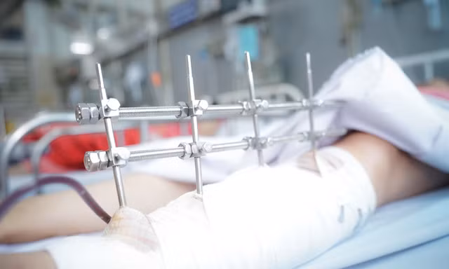 Nữ nạn nhân vụ sập tường kinh hoàng ở Long An đã thoát 'cửa tử'