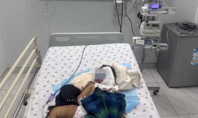 Liên tiếp 2 trẻ bị bỏng nặng trong ngày Tết vì người lớn sơ ý