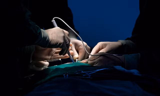 Sau phẫu thuật thẩm mỹ, cô gái trẻ nguy kịch vì xuất huyết não 