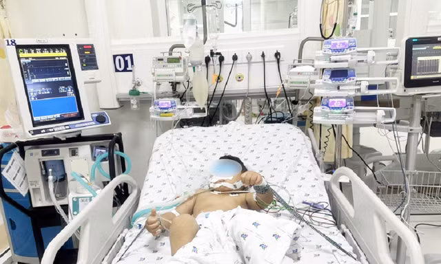 Hai anh em ruột nguy kịch vì bị ong vò vẽ tấn công