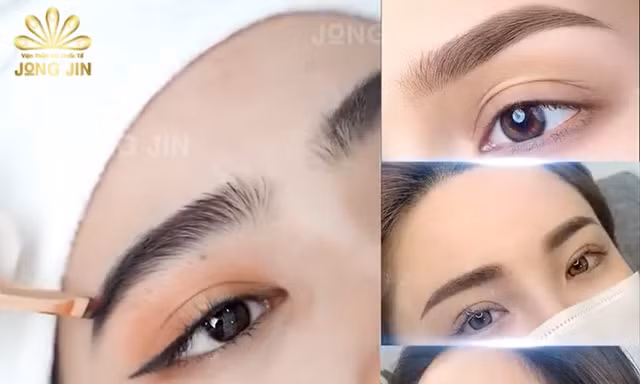 'Cấy kim cương' Viện thẩm mỹ Quốc tế JONGJIN bị phạt nặng, đình chỉ hoạt động