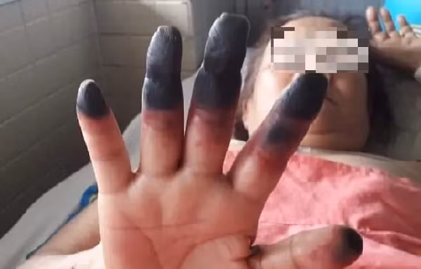 Đau nhức chân tay coi chừng bệnh lý nguy hiểm