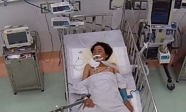 Bị rắn độc tấn công khi ngủ dưới nền nhà, cậu bé 13 tuổi nguy kịch