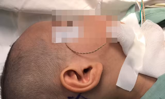 Giải thoát bé trai khỏi cuộc đời câm điếc bẩm sinh