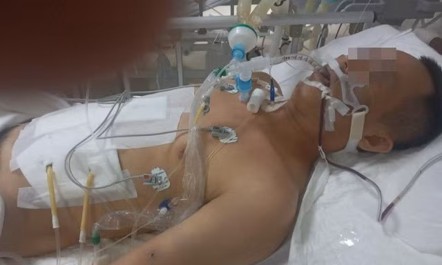 Nhát đâm chí mạng khiến cơ thể nạn nhân 'khô máu'