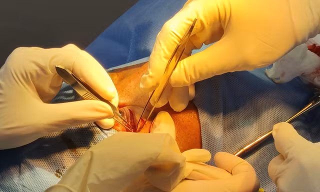 Cứu người đàn ông bị hàng xóm dùng đũa đâm xuyên hốc mắt