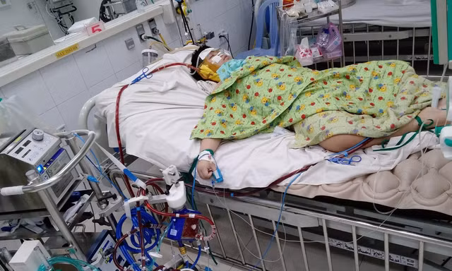Bé trai béo phì mắc COVID-19 nguy kịch vì 'bão Cytokine'