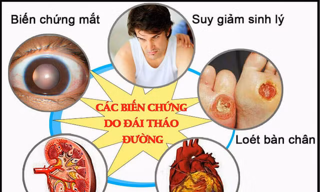 Biến chứng kép tim mạch – võng mạc ở bệnh nhân tiểu đường: Có thể ngăn chặn từ sớm