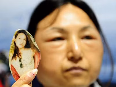 Tham phẫu thuật rẻ, thiếu nữ biến thành bà già