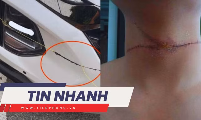 TIN NHANH 12H: Chuyên gia nói về sáp nhập quận Hoàn Kiếm; Dây diều cứa ngang cổ người, chém đầu ô tô