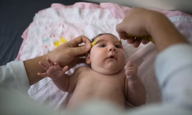 Virus zika gây dị tật đầu nhỏ bẩm sinh đang hoành hành ở châu Mỹ Latinh
