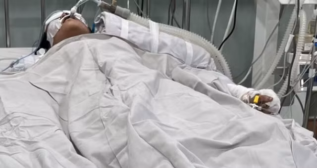Vụ cháy tiệm bánh kem ở TPHCM: 4 bệnh nhân phải thở máy