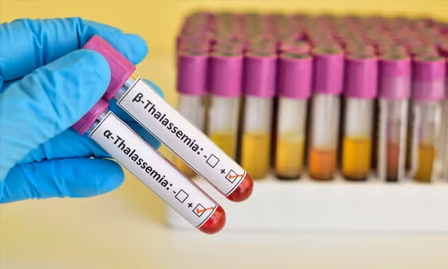 Ngăn chặn bệnh Thalassemia để không ảnh hưởng giống nòi 