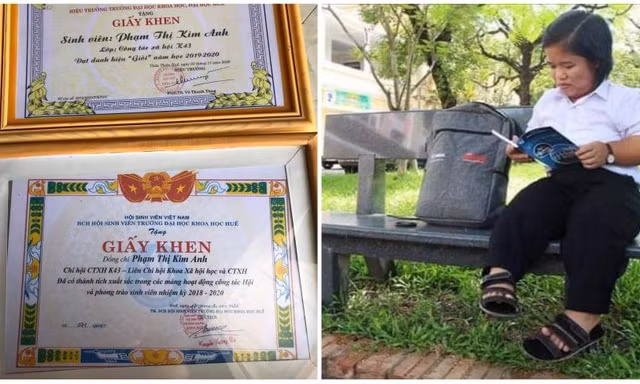 Quyết tâm theo đuổi con chữ khi mang trong mình căn bệnh bẩm sinh