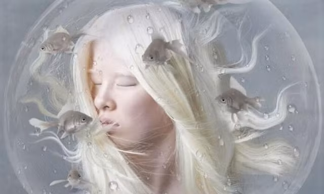 Nghị lực trở thành người mẫu nổi tiếng của cô gái bạch tạng