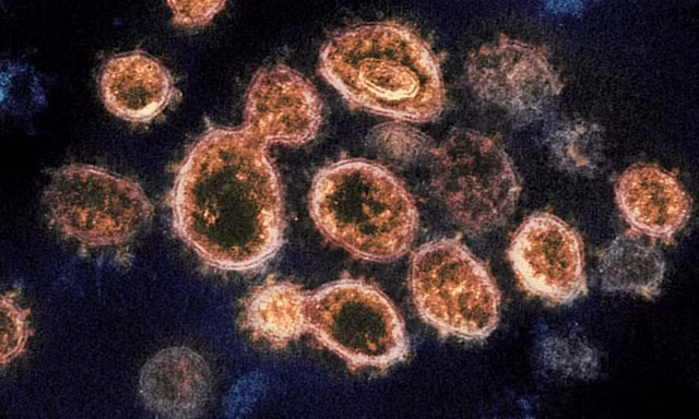 Virus SARS-CoV-2 - một loại virus corona gây bệnh COVID-19. Ảnh: CNN