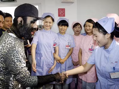 Chàng trai rậm lông muốn có vợ