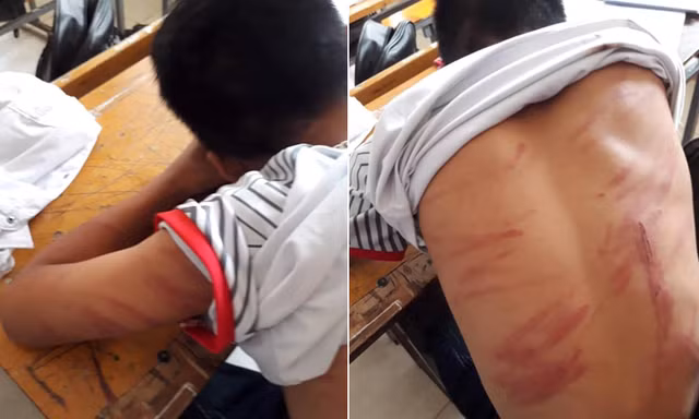 Người bố khai lý do đánh con ngất xỉu phải nhập viện