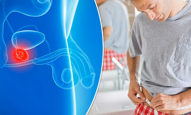 Làm thế nào phát hiện sớm ung thư tuyến tiền liệt?