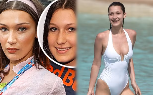 ‘Chân dài’ gợi cảm Bella Hadid khẳng định chưa từng ‘dao kéo’ thẩm mỹ
