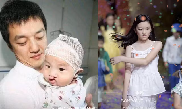 Vì sao con gái dị tật của Lý Á Bằng được nhiều người ngưỡng mộ?