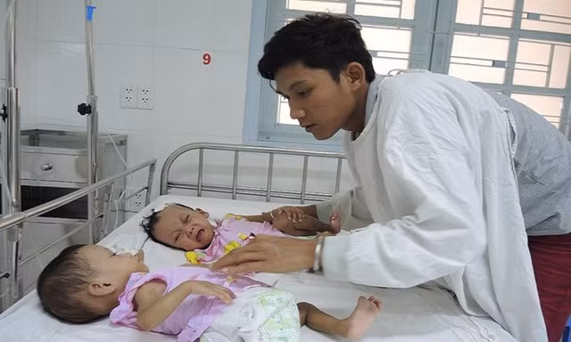 12 giờ 'cân não' tách rời cặp song sinh dính nhau phần xương cụt
