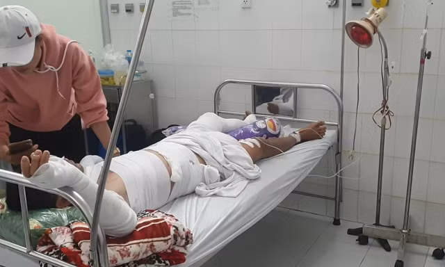 Ghe biển chuẩn bị ra khơi bất ngờ phát nổ làm ba người bị bỏng nặng