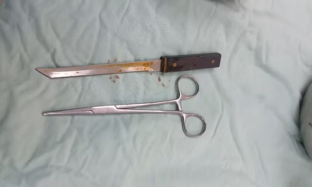 Cãi lộn với vợ, chồng lấy dao tự đâm thủng bụng 
