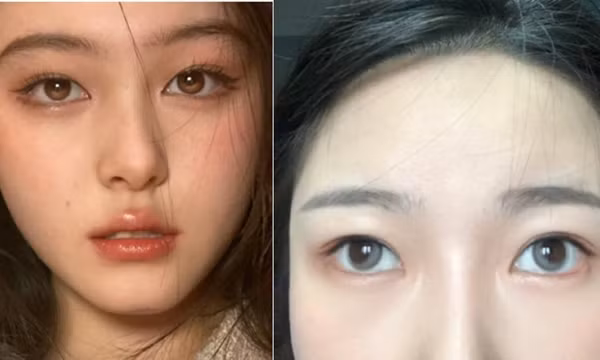 Mua kính áp tròng đang “hot” trên mạng, một loạt khách hàng kêu ca vì kính làm lệch cả mắt