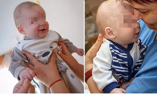 Em bé sinh ra thiếu đi đôi mắt nên bị mẹ bỏ rơi, giờ đã tìm được gia đình yêu thương mình