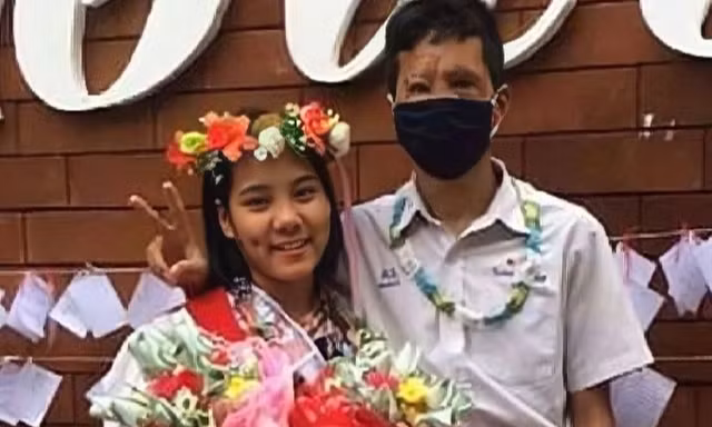 Chuyện tình vượt định kiến của chàng trai có gương mặt biến dạng