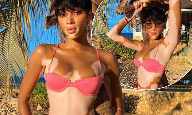 Winnie Harlow quyến rũ hút hồn giữa biển tuyệt đẹp ở Jamaica