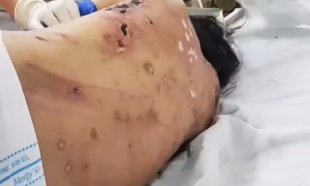 Nữ tiếp viên tố bị chủ ép bán dâm, đánh gãy xương, tra tấn như thời trung cổ