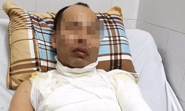 Anh H. điều trị tại bệnh viện.