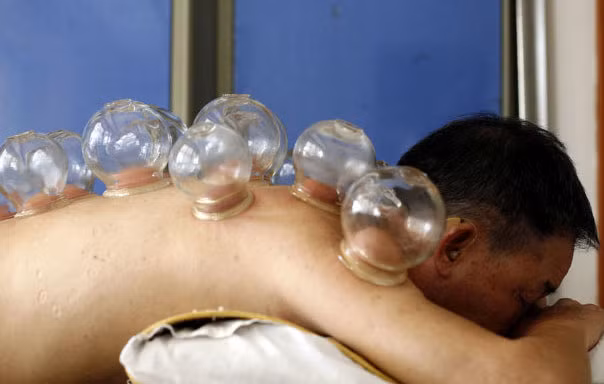 Giác hơi - không phải trò vui